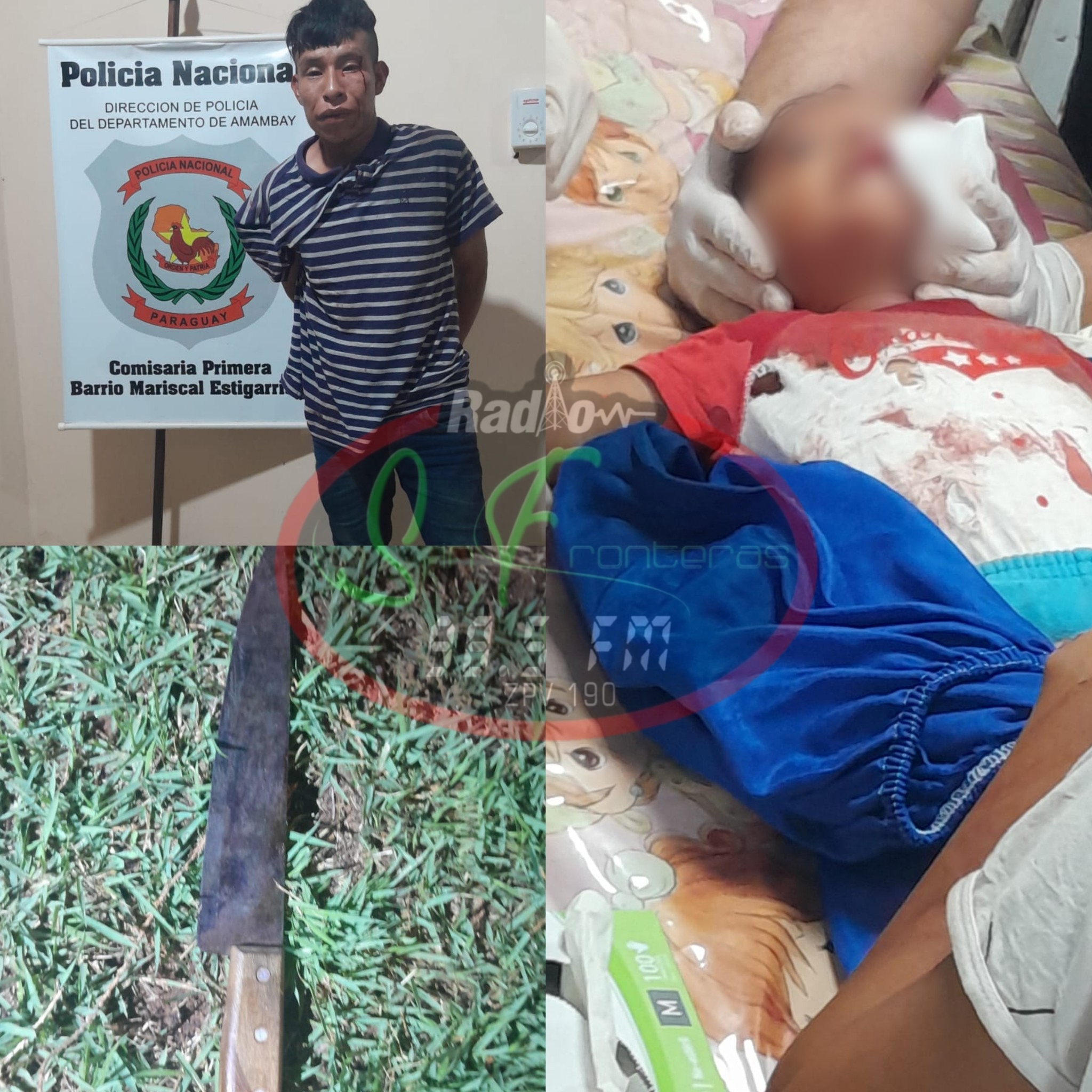 Pedro Juan Caballero: Niño de un año fue herido con cuchillo en el cuello en caso de violencia familiar