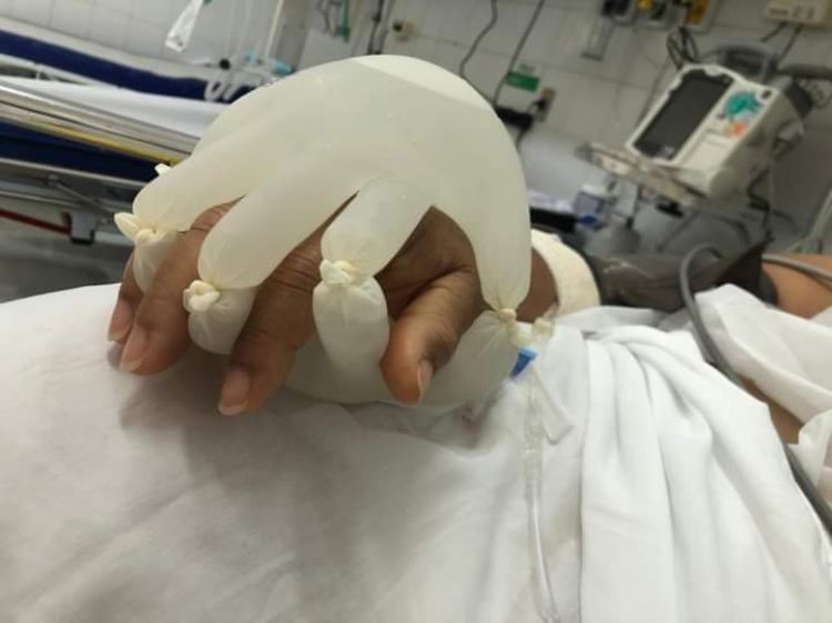 Enfermera crea guantes especiales para “acompañar” a pacientes con COVID-19