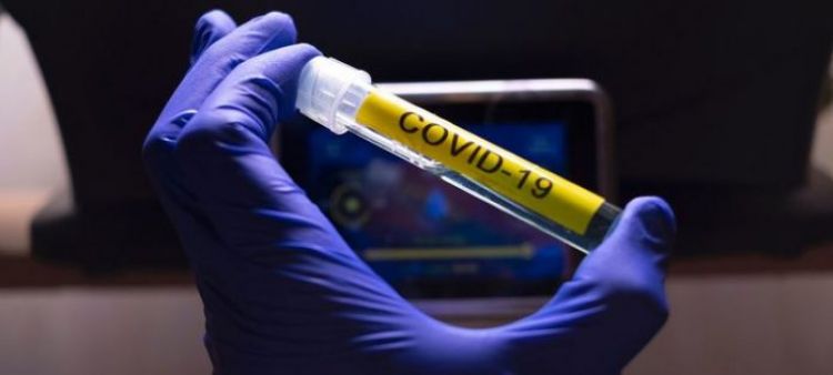 Hong Kong detecta posible brote en laboratorio que investiga el coronavirus
