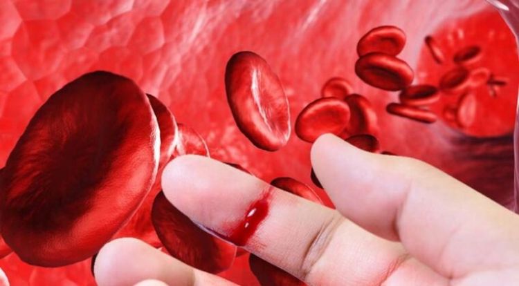 Hemofilia: un tratamiento adecuado es clave para llevar una vida saludable