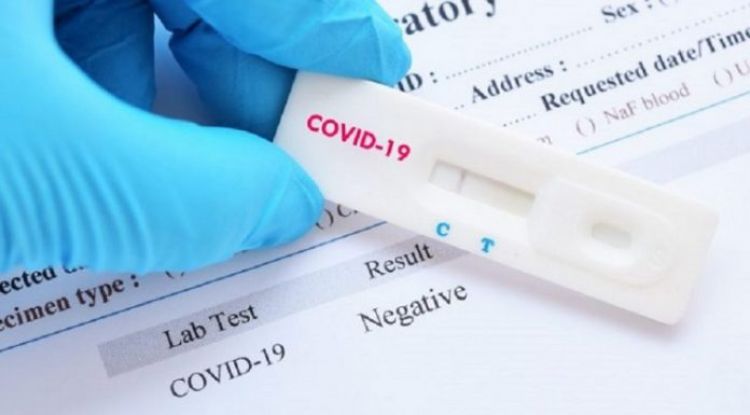 Dos nuevos fallecidos por COVID-19 y 31 casos sin nexo en las últimas 24 horas en Paraguay