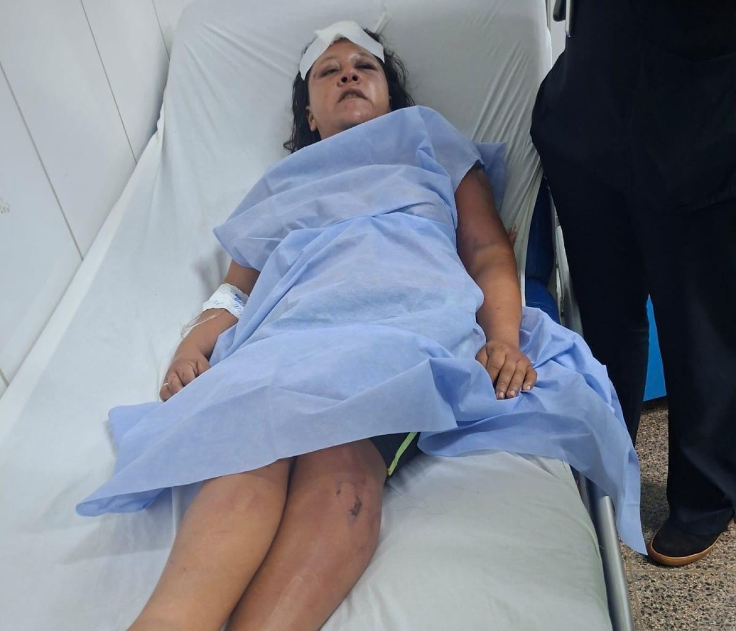 Brutal agresión: mujer termina hospitalizada y el presunto autor tiene orden de captura por homicidio