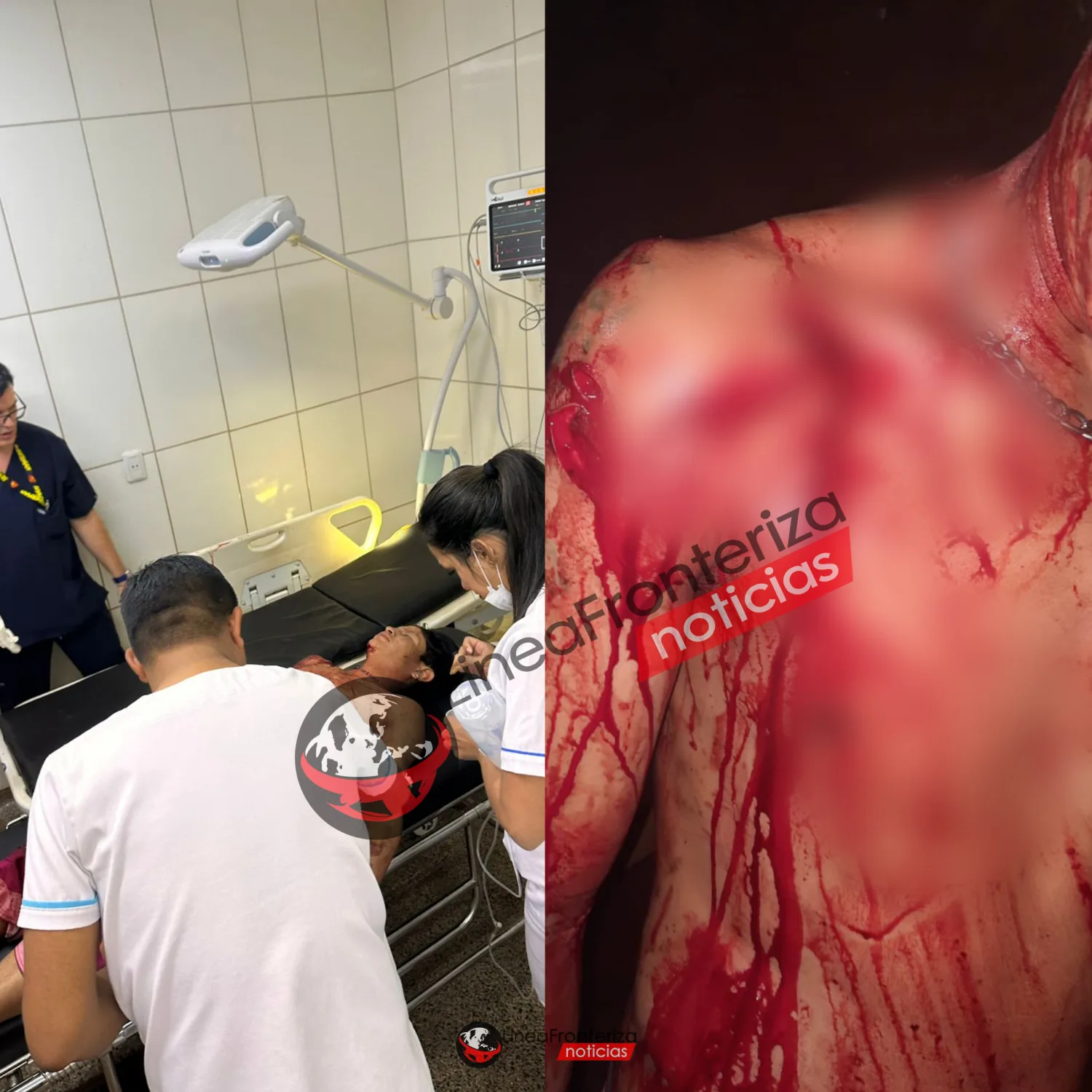 Joven indígena resulta herido con un estoque y señalan a su padre como presunto autor