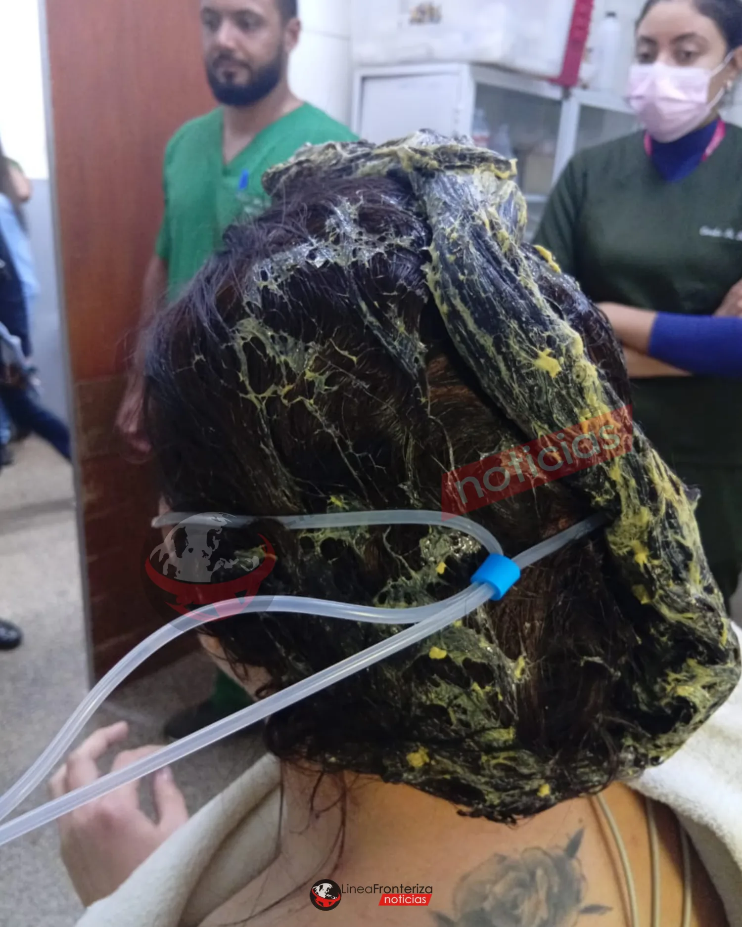 Hombre golpea a su pareja y le arroja cola de zapatero tras discusión por celos en la frontera.