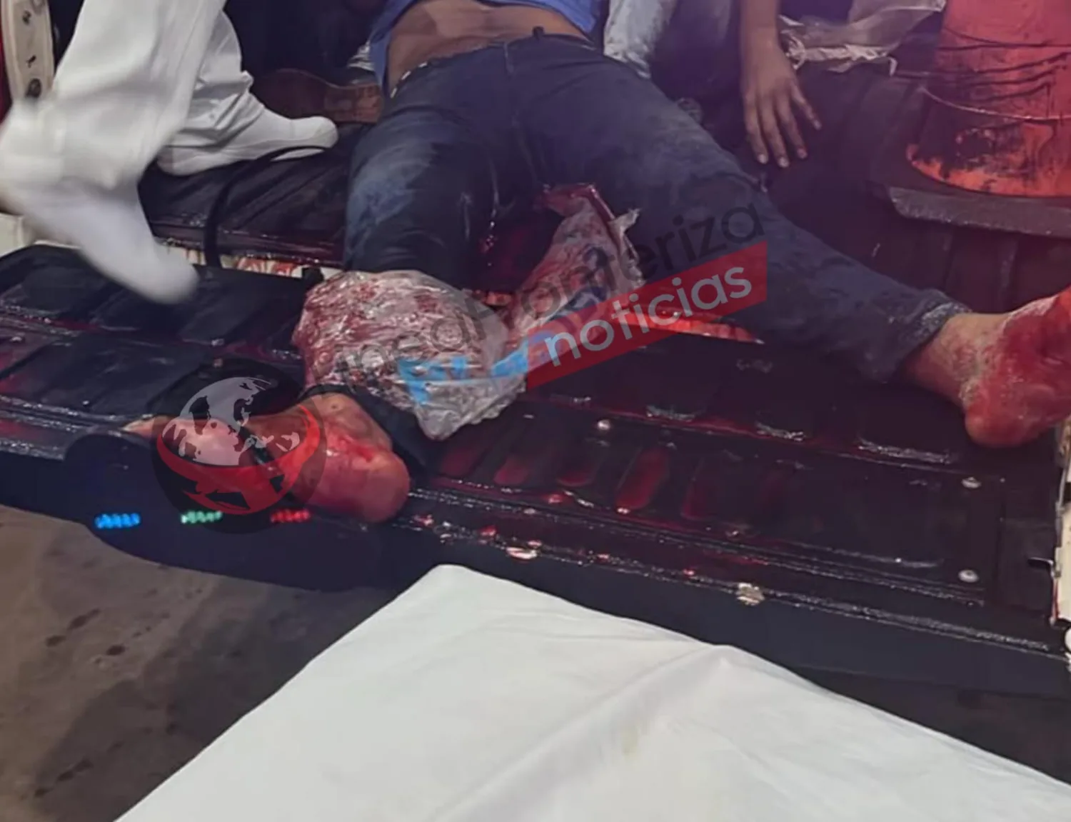 Joven fallece tras sufrir grave corte al romperse una mesa de vidrio