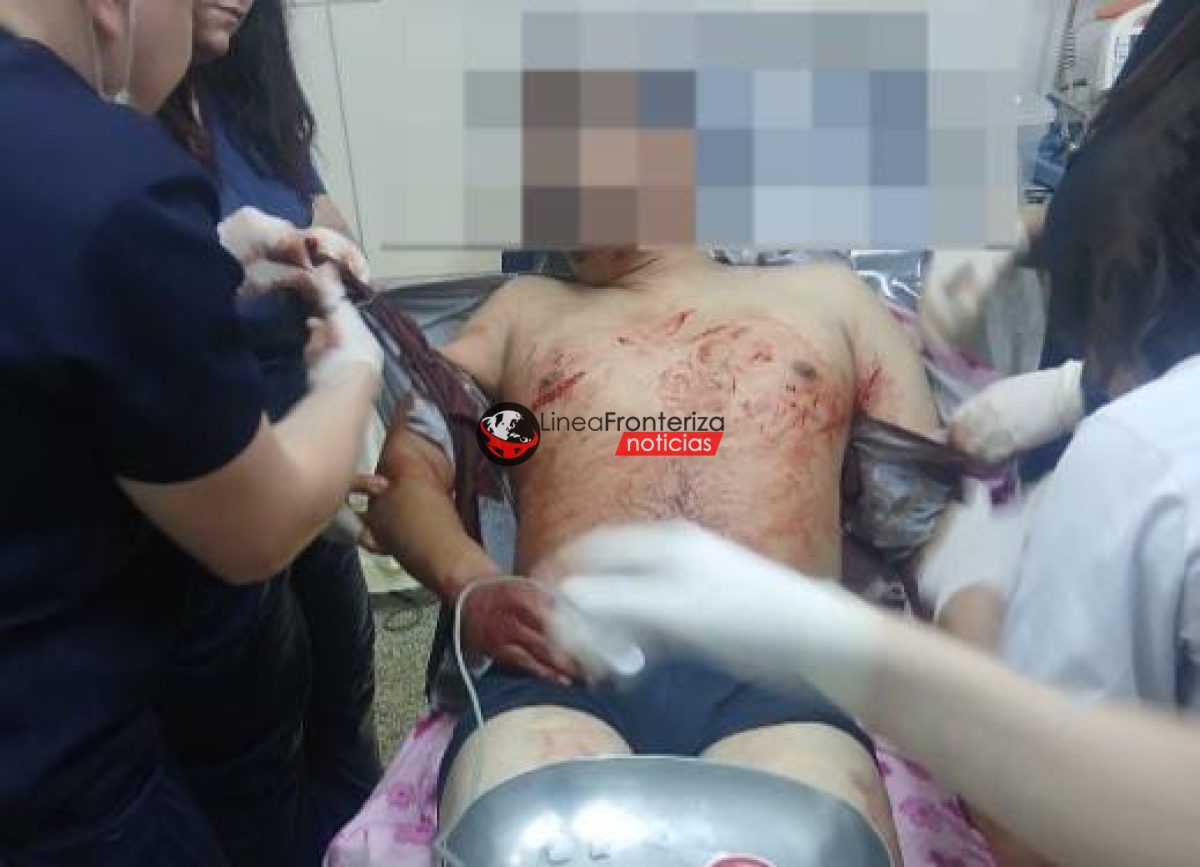HOMBRE FUE APUÑALADO POR EL EX DE UNA MUJER DURANTE LA MADRUGADA